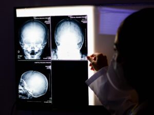 Neurologia Infantil - Módulo 4: Emergências Neurológicas